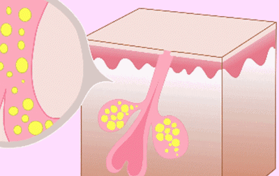 超实用保姆级秋冬护肤攻略，轻松解救秋冬危“肌”