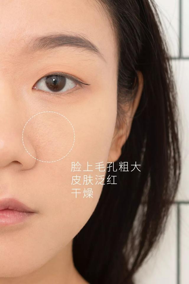 超实用保姆级秋冬护肤攻略，轻松解救秋冬危“肌”