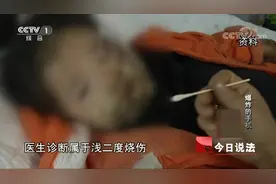 三星手机床头充电爆炸，男子4岁女儿惨被爆炸电池灼伤脸部和双手视频封面
