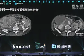 首届腾讯医学ME大会聚焦医学领域最新前沿进展视频封面