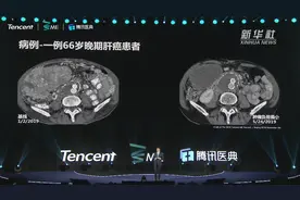 首届腾讯医学ME大会聚焦医学领域最新前沿进展视频封面