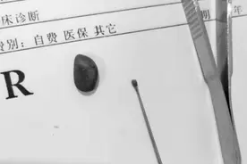 小朋友手中的网红玩具可能有毒 诱发过敏性皮炎等疾病图片