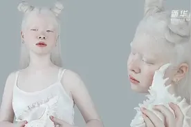 哈萨克斯坦白化病姐妹拍写真走红网络视频封面