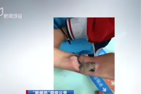 儿童智能手表突然冒烟自燃，温度急速升高，四年级女孩手腕被烫伤视频封面