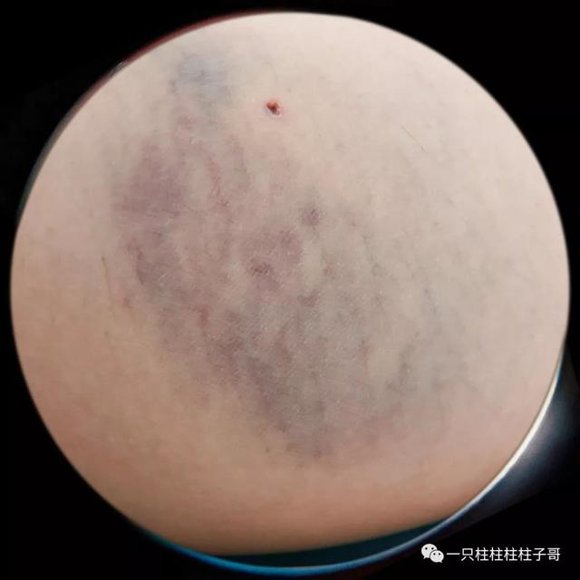 凡士林身体乳青色
