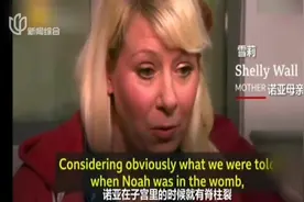 能说爱笑！“无脑儿”长大，脑组织从2%长到80%，创造奇迹！视频封面