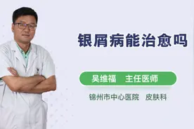 银屑病能治愈吗