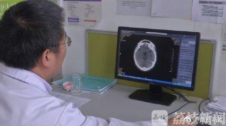 健忘症是怎么回事（年纪轻轻老忘事儿）