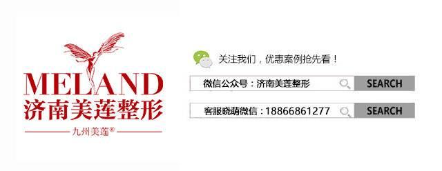 什么是吊眼梢（总是被人说长得凶）