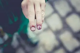 3岁小男孩爱啃指甲，妈妈紧急纠正，奶奶：不就吃个手，有啥要紧图片