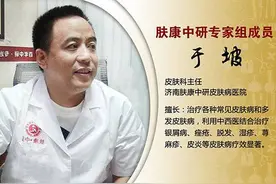 头皮屑多如雪？加醋洗头等土方并不靠谱！教你正确的去屑方法图片