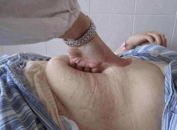 蛋白质粉可以下奶吗 2025年蛋白粉能帮助下奶吗