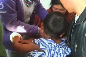 放个鞭炮，云南三岁男童的右手基本毁了……图片