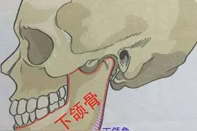 韩啸水蜜桃下颌截骨术通过什么方式拯救方脸？图片