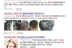 “白头发拔一根长十根”？这事儿终于有答案了图片