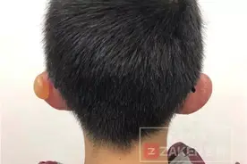 看着就心疼！东北男孩大冷天踢足球冻伤 这些细节值得家长注意图片