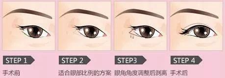 总是被人说长得凶，一看就不是好人，真的是很苦恼啊