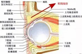 我是肿眼泡，割了双眼皮会好看么？图片