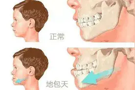 青枝折痕—成人地包天改“斜”归正图片