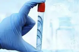 余姚男子结婚多年的妻子竟然是小姨子 亲子鉴定“验明正身”图片