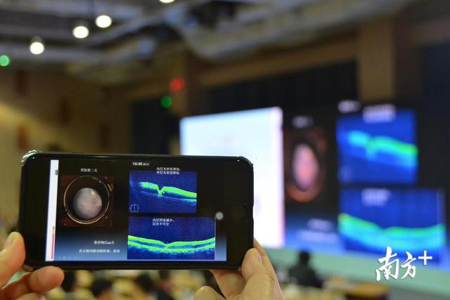 汕头国际眼科中心入选省高水平专科