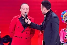 童星阿尔法分享自己植发经历 劝诫网友不要熬夜图片