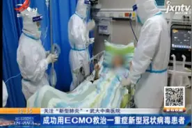 武大中南医院：成功用ECMO救治一重症新型冠状病毒患者