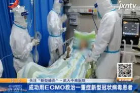 武大中南医院：成功用ECMO救治一重症新型冠状病毒患者视频封面