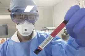化学发光新冠病毒试剂盒研制成功：采血检测，22分钟出结果图片