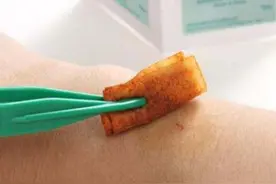小伤口消毒，备好这些常用药图片