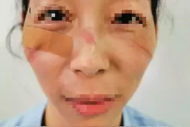 压伤、消毒手、足发白……  @医护人员，抗疫期间皮肤问题药方请查收图片
