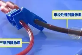 慈海一院：康复科最新引进安全、绿色、高效的三氧大自血疗法图片