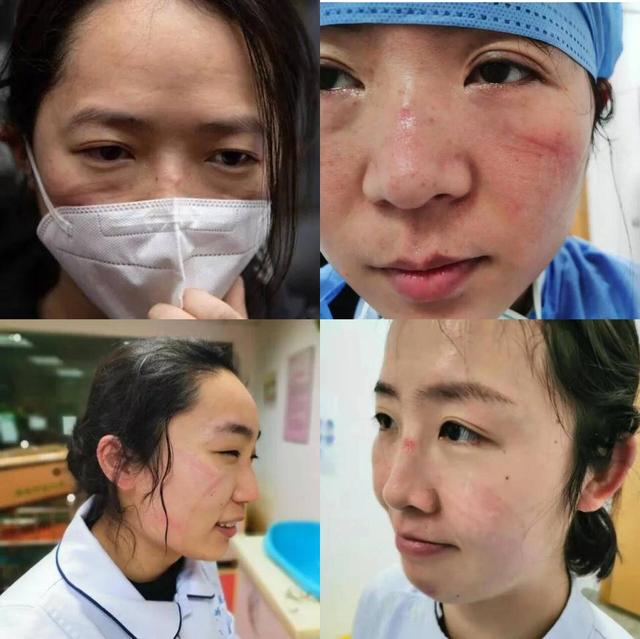 鎴村彛缃╁鑷磋劯杩囨晱锛屽揩鎵捐繖13娆剧儹閿€闀囬潤鑸掓晱鍠烽浘