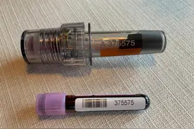 放大招？孙杨晒出完好无损的血检样品 其牙科医生发文力挺图片