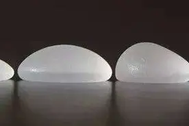 假体丰胸疼不疼真相—传统假体隆胸的弊端之一图片