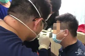 合肥一男子钓鱼不慎被鱼钩挂住鼻子 来到消防队求助图片