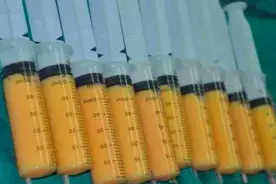 吸脂手术后有没有后遗症？如何进行术后护理？图片