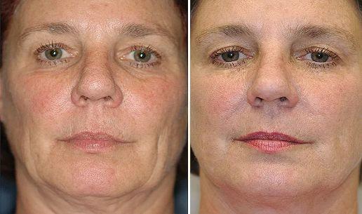 有每天吃花胶的姐妹吗 每天都吃花胶