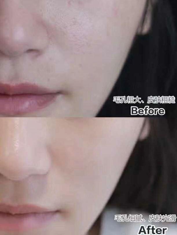 坚持吃花胶的姐妹效果 2026年吃花胶真的可以美容养颜吗