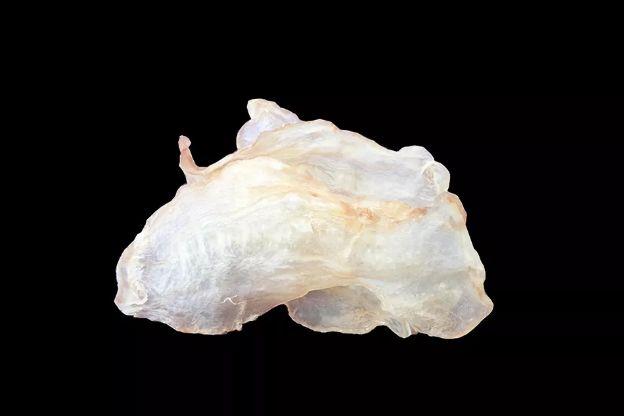 乳腺增生 可以吃花胶吗 2025年乳腺增生可以吃花胶吗女性