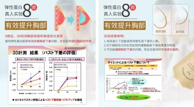 常吃花胶会乳腺增生吗 常吃花胶会乳腺增生吗会加重吗