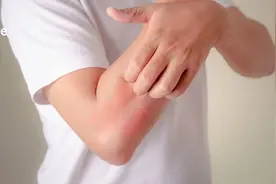 没有一个怕痒的人，可以坚持到看完全文图片