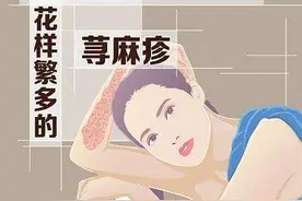 春天一到，皮肤就反复瘙痒、肿痛，有什么方法能赶走荨麻疹？图片