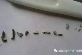 如果医生建议你去做这件事，别犹豫！绝对是为你好……图片