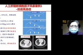 李兰娟：人工肝血液净化可治新冠危重症视频封面