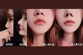 女子用了9块9「美鼻神器」差点丢了命图片