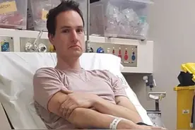 物理博士抗疫憋家无聊搞发明翻车，把四块磁铁卡鼻孔里出不来了？图片