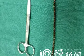 小珠子大危险 两岁女童误食51颗磁力珠图片