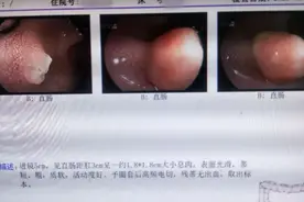 不痛吗？台州2岁女童割掉一块“肉”，医生手术没打麻药图片