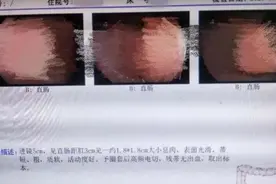 台州2岁女童割掉一块“肉”医生手术竟没打麻药图片